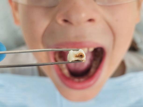 Best Urgent Tooth Repair  in Shelby, MT
